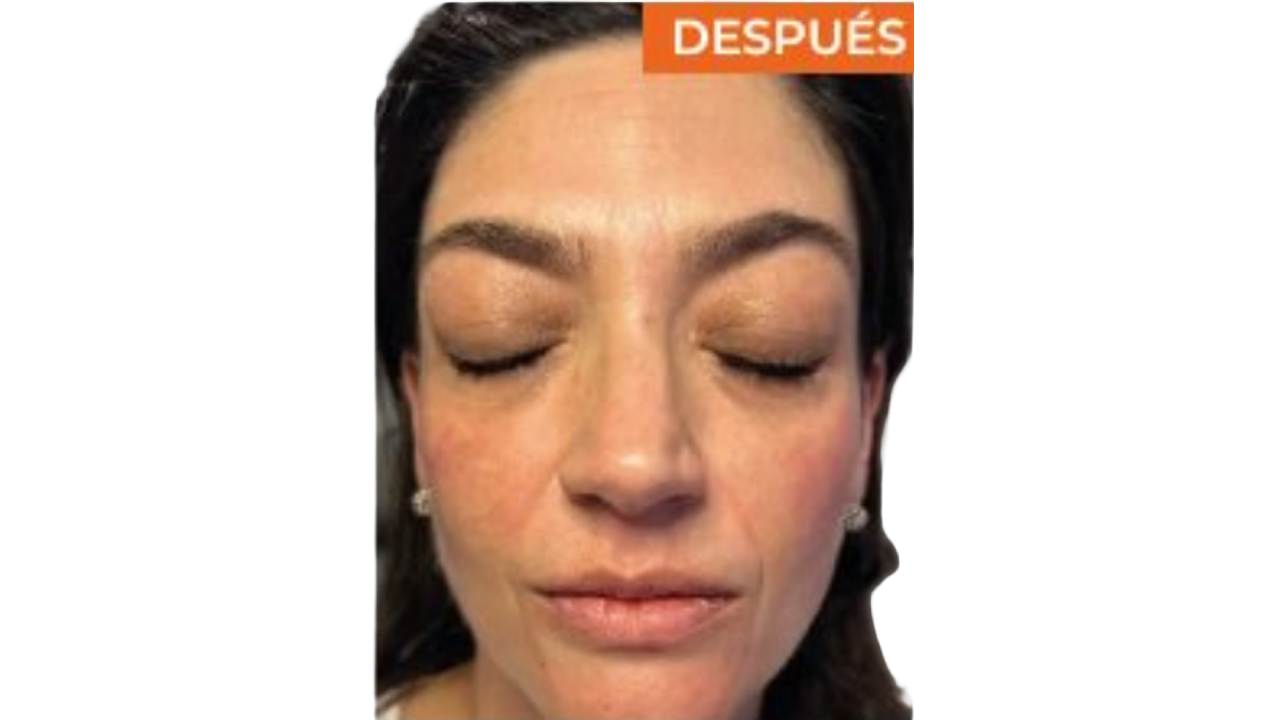 Después